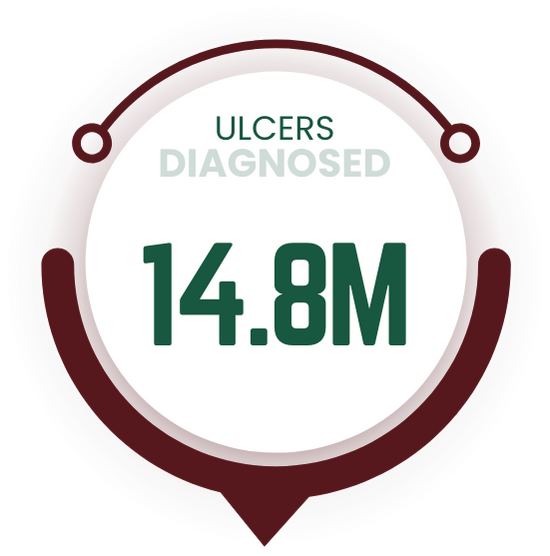 Image showing a circular badge with the text "ULCERS DIAGNOSED" at the top and "14.8M" in large numbers below, indicating 14.8 million ulcer diagnoses.