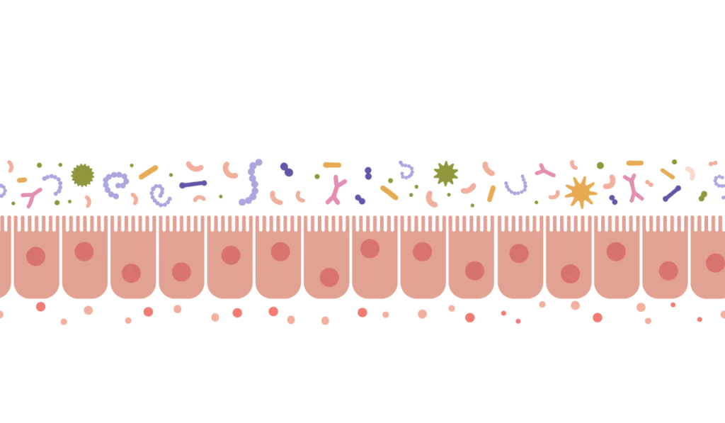 Abdominal-Pain-Obstructive-Bowel Disorders-OBD