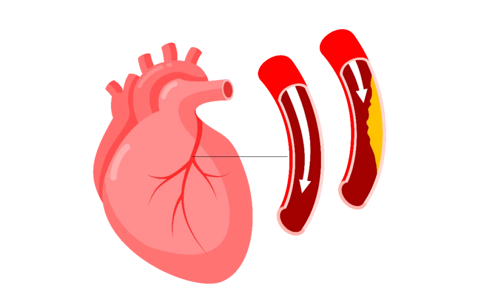 heart-health-gut-microbiota-cardiovascular-disease