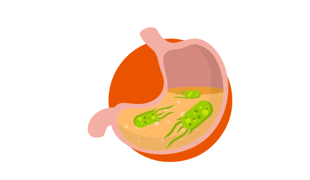 VSL#3-Irritable-Bowel-Syndrome