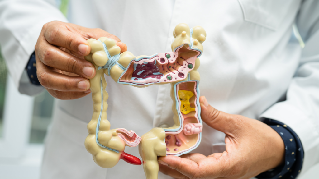 Gut Obstruction Symptoms: A Comprehensive Guide