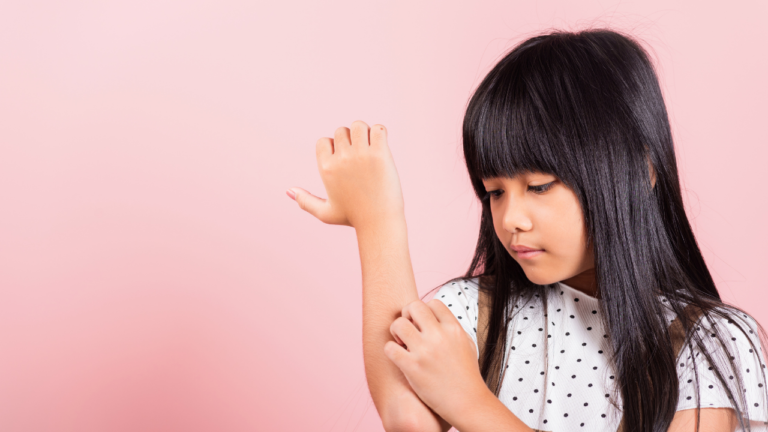 Top 5 Anti-Itch Creams for Quick Relief: Bite of a Bed Bug in 2023